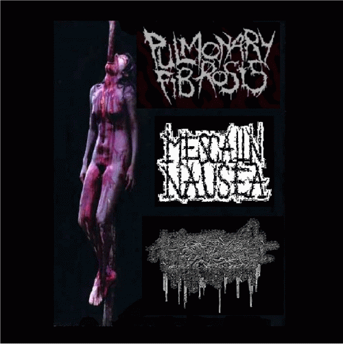 Pulmonary Fibrosis : Pulmonary Fibrosis - Mescalin Nausea - Rectal Blastophobiec Injection